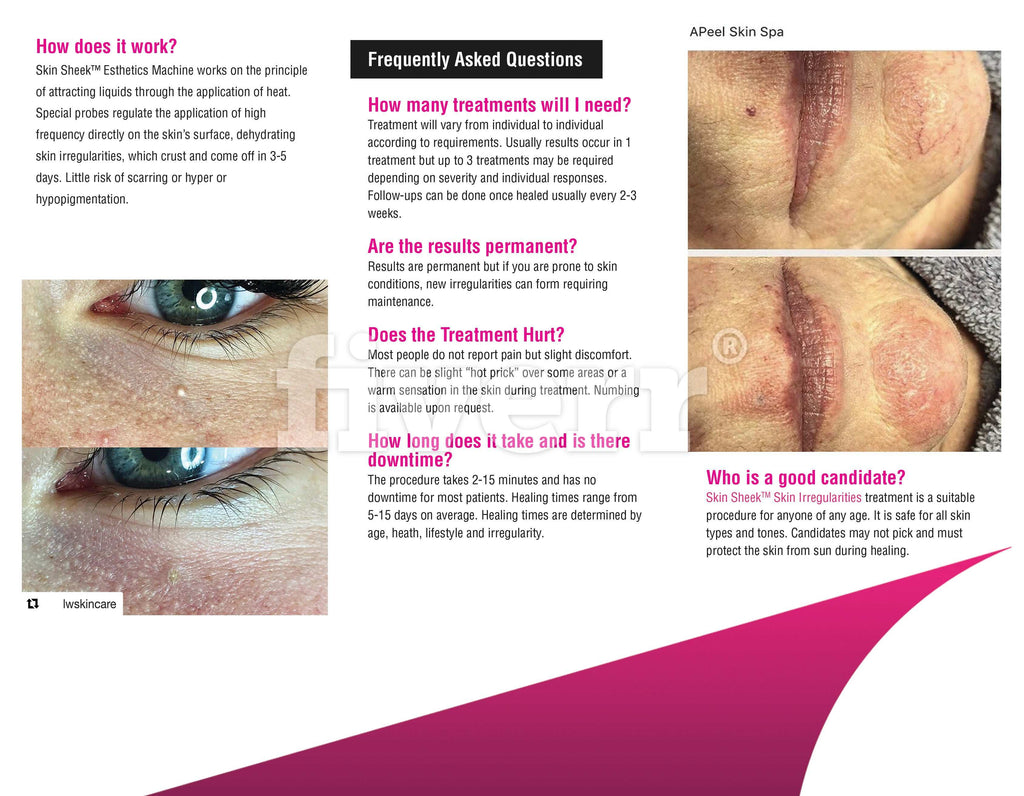 Clear Brochure