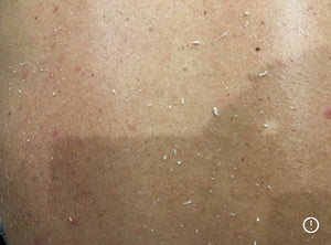 Skin Sheek Xposed Instant Exfoliating Spray