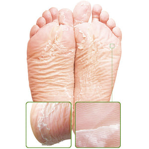 Sheeky Foot™ Exfoliating Foot Peel and Callus Remover