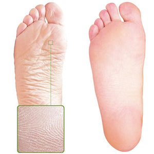 Sheeky Foot™ Exfoliating Foot Peel and Callus Remover