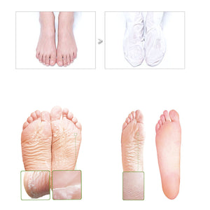 Foot Callus Remover Mask For Dead, Dry and Peeling Skin, Rough Heels Feet  Exfoliating Peel Scrub Results in Baby Soft, Silky, and Smooth Skin in 7-10